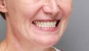Пациент Алевтина – протезирование зубов