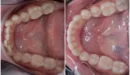 Пациент Дарья – ортодонтия